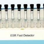 ESR FAST DETECTOR   10-Position,ABS,1pc/color box